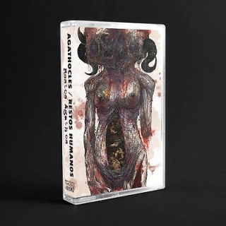 Agathocles / Restos Humanos